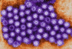 norovirus 10 Most Common Diseases Found in Hospitals